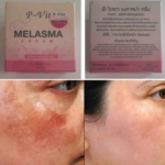Bioaqua P Vita Melasma Mesta Whitening Cream -10 gm (Thailand) - Image 6