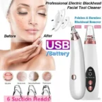 Blackhead Remover Instrument Black Dot Remover Acne Vacuum Suction Face Clean Black Head Pore Cleaning Beauty Skin Care Tool - Black Head Remover - Darma Roller - Image 6
